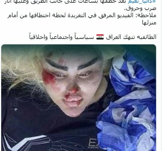 عاجل.. قفزت من السيارة.. نجاة بلوجر عراقية شهيرة بعد اختطافها