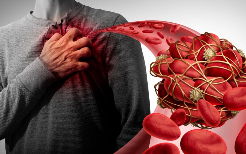 ما هي أعراض انسداد شرايين القلب؟